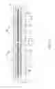 Fig. 11 - PHYSICAL QUANTITY SENSOR, ELECTRONIC DEVICE, AND MOVING OBJECT