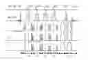 Fig. 01 - Two-dimensional semi-LASER correlation spectroscopy with well-maintained cross peaks