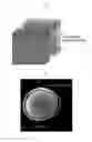 Fig. 03 - Magnetic resonance imaging method using T2* mapping based on echo planar imaging