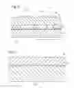 Fig. 12 - Ultrasonic sensor microarray and its method of manufacture