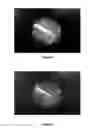 Fig. 08 - SYSTEM AND METHOD FOR REAL-TIME THREE DIMENSIONAL DOSIMETRY