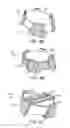 Fig. 07 - Autonomous seismic nodes for the seabed