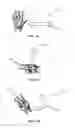 Fig. 20 - VEHICLE AND DEVICE SOFTWARE UPDATES PROPAGATED VIA A VIRAL COMMUNICATION CONTACT