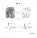 Fig. 03 - User authentication method and apparatus based on fingerprint and electrocardiogram (ECG) signal