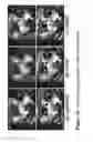 Fig. 13 - Vision correcting display with aberration compensation using inverse blurring and a light field display