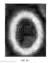 Fig. 07 - Tissue object-based machine learning system for automated scoring of digital whole slides