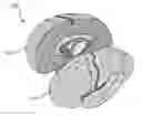 Fig. 01 - Improving symmetry in brain scans