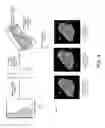 Fig. 05 - Enhancements for displaying and viewing Tomosynthesis images