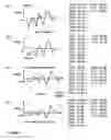 Fig. 06 - Relative excitation features for speech recognition