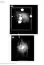 Fig. 08 - Metal induced nanocrystallization of amorphous semiconductor quantum dots