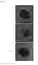 Fig. 10 - Metal induced nanocrystallization of amorphous semiconductor quantum dots