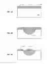 Fig. 06 - METHOD AND SYSTEM FOR FORMATION OF P-N JUNCTIONS IN GALLIUM NITRIDE BASED ELECTRONICS