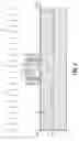 Fig. 04 - Self-aligned emitter-base bipolar junction transistor with reduced base resistance and base-collector capacitance