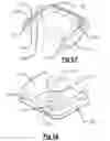 Fig. 10 - Protective case for portable electronic device with integrated dispensable and retractable charge and sync cable