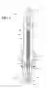 Fig. 03 - Spark plug with improved seal