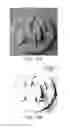Fig. 11 - High-resolution surface measurement systems and methods