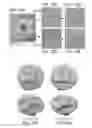 Fig. 15 - High-resolution surface measurement systems and methods
