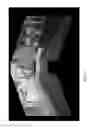 Fig. 03 - Vehicle vision system with panoramic view