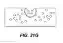 Fig. 29 - Deformable ear tip for earphone and method therefor