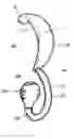 Fig. 01 - External ear insert for hearing comprehension enhancement