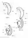 Fig. 04 - External ear insert for hearing comprehension enhancement