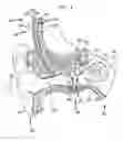 Fig. 02 - Smoothing power consumption of an active medical device