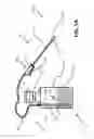 Fig. 02 - Dispenser for Dispensing Foam such as Foam Herbicides
