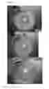 Fig. 03 - Disinfectant Formulation Comprising Calcium Hydroxide and Sodium Hypochlorite