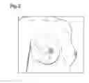 Fig. 03 - Clothing article having cup parts