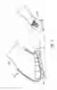 Fig. 11 - Decoupled foot stabilizer system