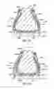 Fig. 31 - Decoupled foot stabilizer system