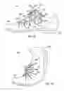 Fig. 37 - Decoupled foot stabilizer system