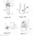 Fig. 08 - High heel shoe inserts