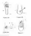 Fig. 15 - High heel shoe inserts