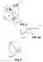 Fig. 04 - Elongate medical device with articulating portion