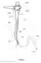 Fig. 07 - Methods, devices and systems for improved hygiene during endoscopic procedures