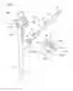 Fig. 02 - Endoscopic treatment device