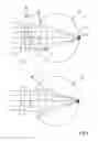 Fig. 02 - Method and system for determining the refractive properties of an eye of a child