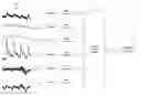 Fig. 01 - Peak Detection System and Method for Calculation of Signal-Derived Metrics