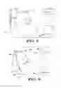 Fig. 09 - Use of detection profiles in an implantable medical device