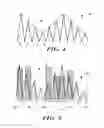 Fig. 04 - Methods and implantable devices for detecting arrhythmia