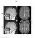 Fig. 06 - Brain activity measuring apparatus and brain activity measuring method