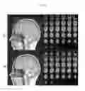 Fig. 07 - Brain activity measuring apparatus and brain activity measuring method