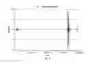 Fig. 15 - Method and apparatus for detecting seizures