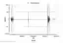 Fig. 20 - Method and apparatus for detecting seizures