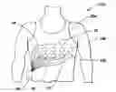 Fig. 01 - Wearable ambulatory medical device with multiple sensing electrodes