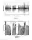Fig. 16 - MASK AND METHOD FOR BREATHING DISORDER IDENTIFICATION, CHARACTERIZATION AND/OR DIAGNOSIS