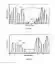Fig. 17 - MASK AND METHOD FOR BREATHING DISORDER IDENTIFICATION, CHARACTERIZATION AND/OR DIAGNOSIS