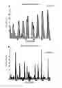 Fig. 23 - MASK AND METHOD FOR BREATHING DISORDER IDENTIFICATION, CHARACTERIZATION AND/OR DIAGNOSIS