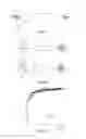 Fig. 13 - Electrocardiogram analysis
